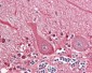 SEPT4 / Septin 4 Antibody (Internal)